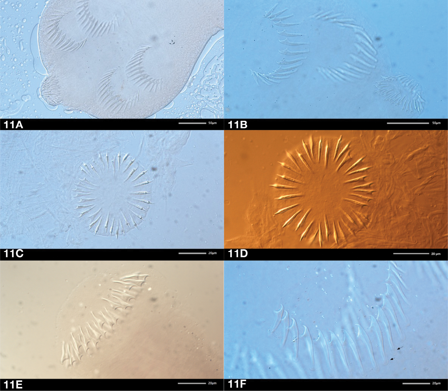 Rostellum platyhelminthes. Talajban élő férgek | Körinfo